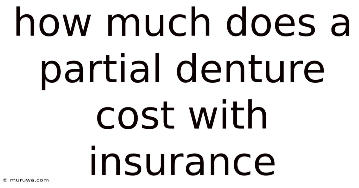 How Much Does A Partial Denture Cost With Insurance How Much Does A Partial Denture Cost With Insurance