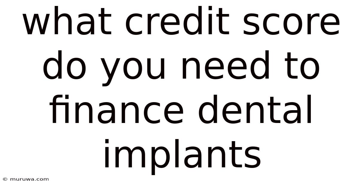 What Credit Score Do You Need To Finance Dental Implants What Credit Score Do You Need To Finance Dental Implants